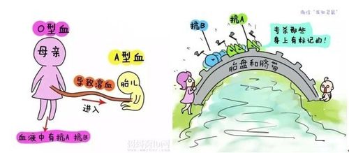 父母血型与新生儿溶血症：预防与应对，守护宝宝健康