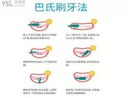 如何正确刷牙：详解巴氏刷牙法的步骤与技巧